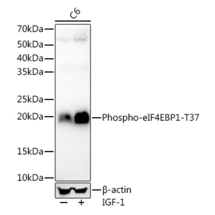 Western Blot - Anti-eIF4EBP1 (phospho Thr37) Antibody [ARC56857] (A309358) - Antibodies.com