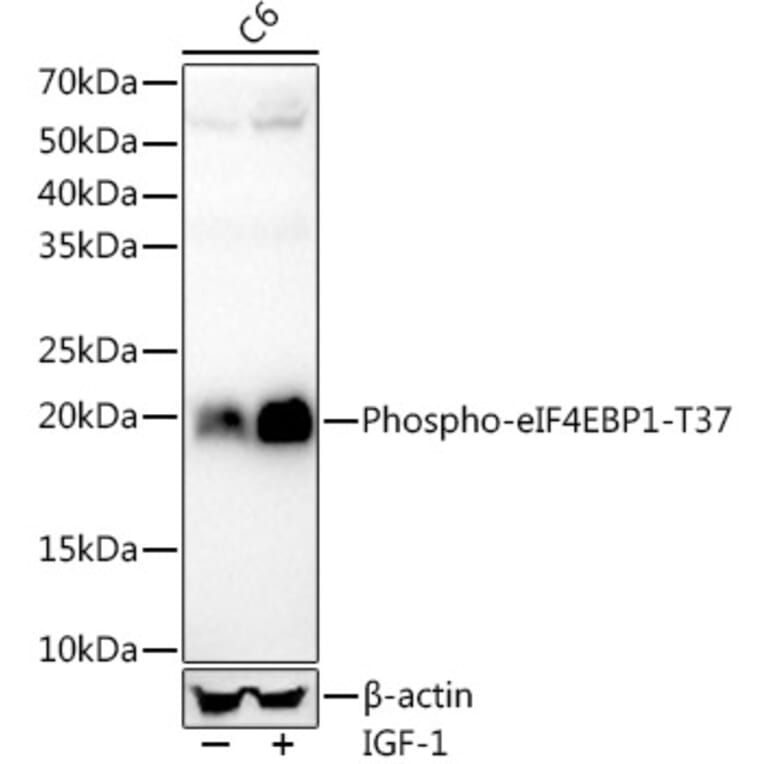 Western Blot - Anti-eIF4EBP1 (phospho Thr37) Antibody [ARC56857] (A309358) - Antibodies.com