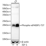 Western Blot - Anti-eIF4EBP1 (phospho Thr37) Antibody [ARC56857] (A309358) - Antibodies.com