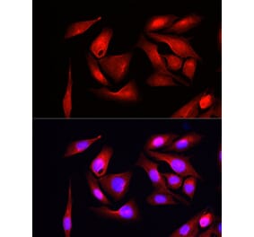 Immunofluorescence - Anti-eIF4EBP1 Antibody (A309360) - Antibodies.com