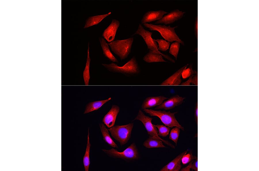 Immunofluorescence - Anti-eIF4EBP1 Antibody (A309360) - Antibodies.com