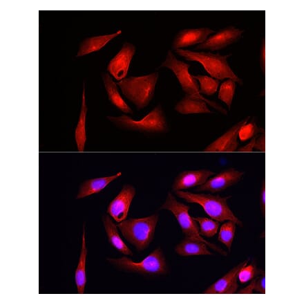 Immunofluorescence - Anti-eIF4EBP1 Antibody (A309360) - Antibodies.com