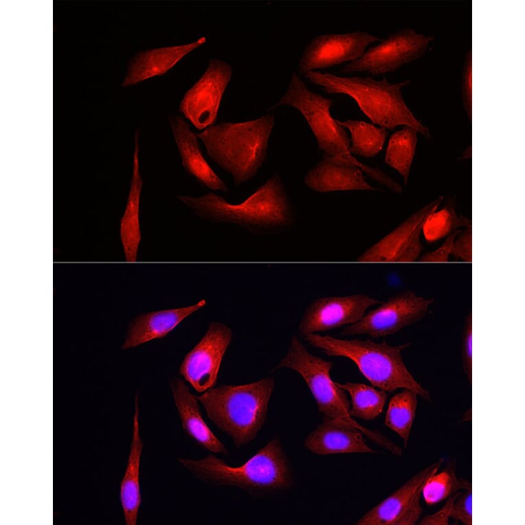 Immunofluorescence - Anti-eIF4EBP1 Antibody (A309360) - Antibodies.com