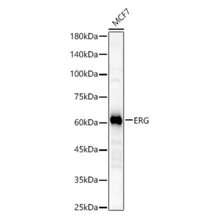 Western Blot - Anti-ERG Antibody [ARC58302] (A309363) - Antibodies.com