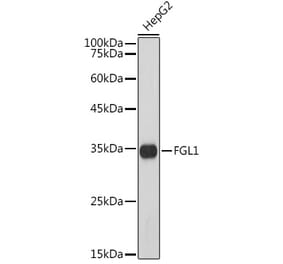 Western Blot - Anti-FGL1 Antibody [ARC5134-01] (A309365) - Antibodies.com