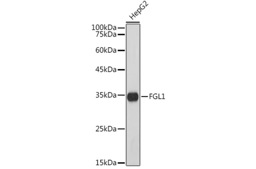 Western Blot - Anti-FGL1 Antibody [ARC5134-01] (A309365) - Antibodies.com
