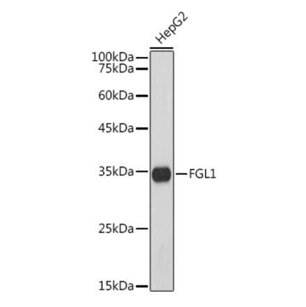 Western Blot - Anti-FGL1 Antibody [ARC5134-01] (A309365) - Antibodies.com