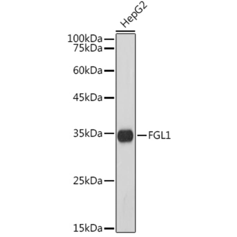 Western Blot - Anti-FGL1 Antibody [ARC5134-01] (A309365) - Antibodies.com