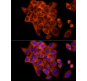 Immunofluorescence - Anti-FRAT1 Antibody [ARC2842] (A309366) - Antibodies.com