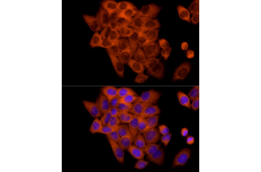 Immunofluorescence - Anti-FRAT1 Antibody [ARC2842] (A309366) - Antibodies.com