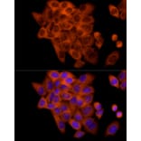 Immunofluorescence - Anti-FRAT1 Antibody [ARC2842] (A309366) - Antibodies.com