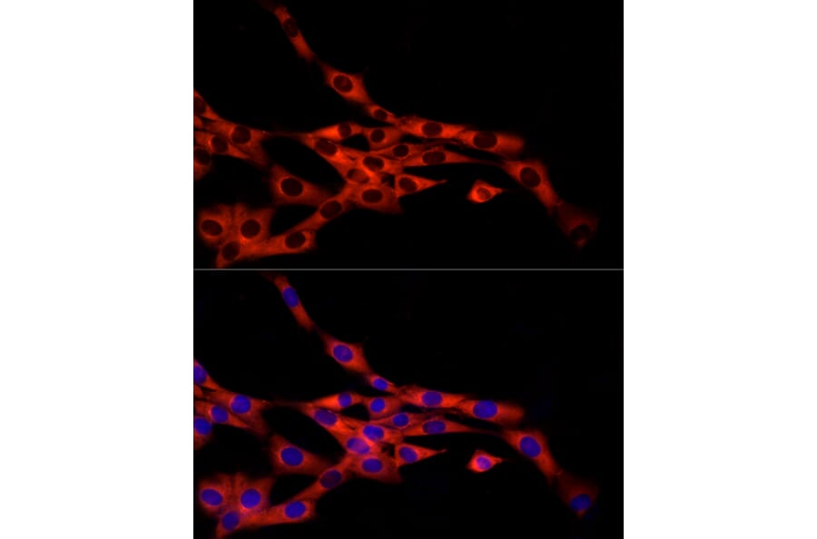 Immunofluorescence - Anti-FRAT1 Antibody [ARC2842] (A309366) - Antibodies.com