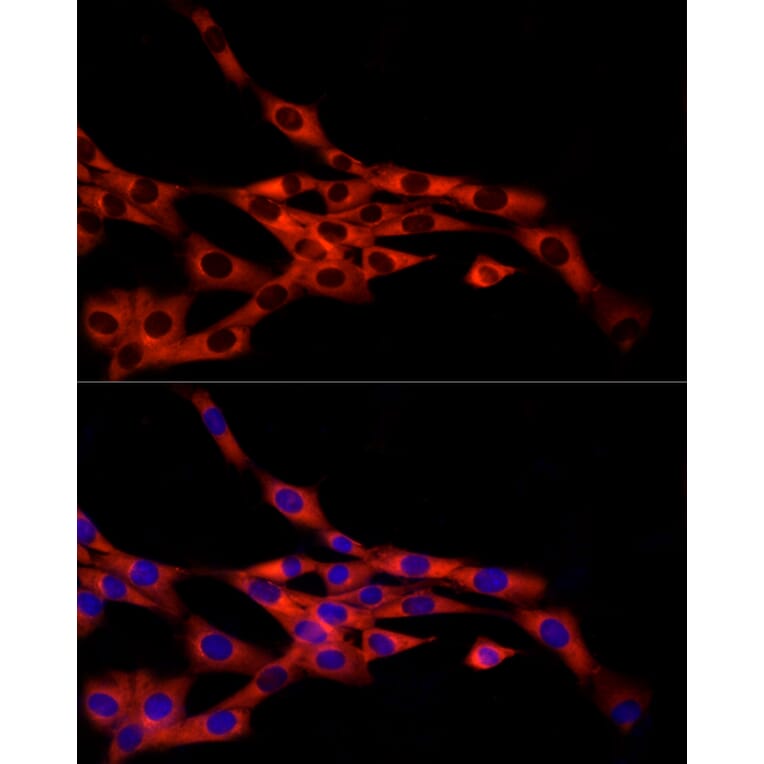 Immunofluorescence - Anti-FRAT1 Antibody [ARC2842] (A309366) - Antibodies.com