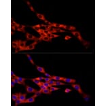 Immunofluorescence - Anti-FRAT1 Antibody [ARC2842] (A309366) - Antibodies.com