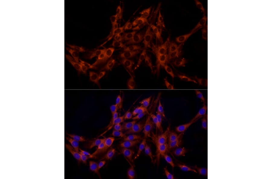 Immunofluorescence - Anti-FRAT1 Antibody [ARC2842] (A309366) - Antibodies.com