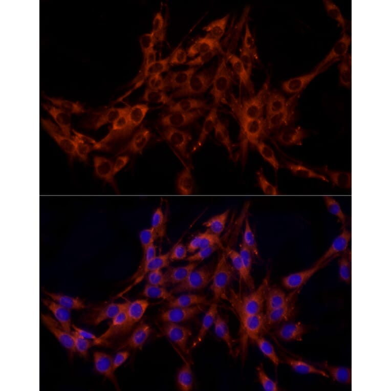 Immunofluorescence - Anti-FRAT1 Antibody [ARC2842] (A309366) - Antibodies.com