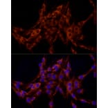 Immunofluorescence - Anti-FRAT1 Antibody [ARC2842] (A309366) - Antibodies.com