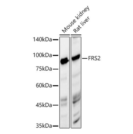 Western Blot - Anti-FRS2 Antibody [ARC57138 + ARC5714] (A309369) - Antibodies.com