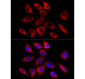 Immunofluorescence - Anti-GALC Antibody [ARC58990] (A309371) - Antibodies.com