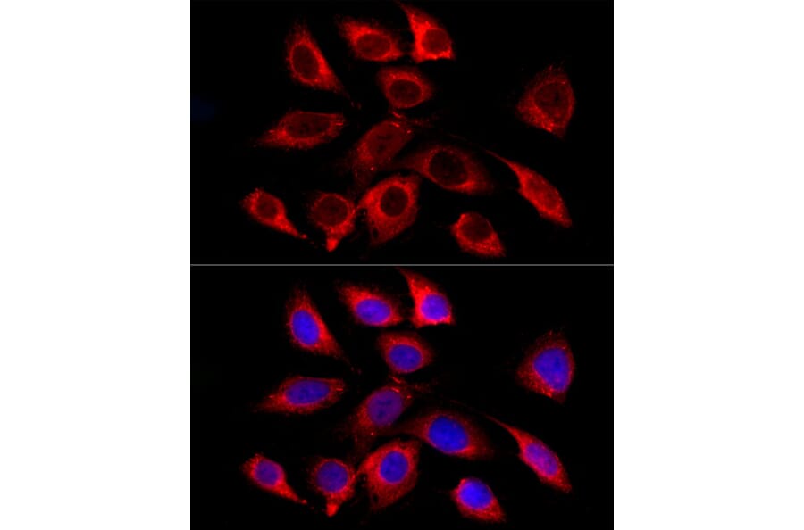 Immunofluorescence - Anti-GALC Antibody [ARC58990] (A309371) - Antibodies.com