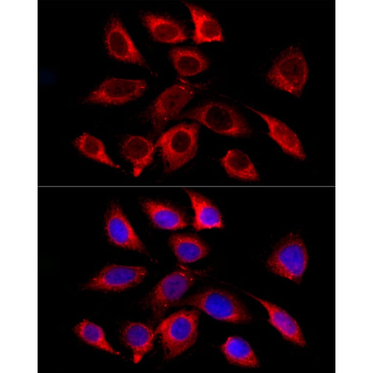 Immunofluorescence - Anti-GALC Antibody [ARC58990] (A309371) - Antibodies.com