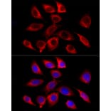 Immunofluorescence - Anti-GALC Antibody [ARC58990] (A309371) - Antibodies.com