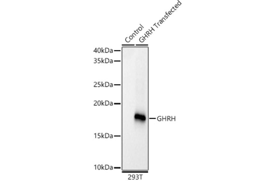 Western Blot - Anti-GHRH Antibody [ARC59237] (A309373) - Antibodies.com