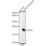 Western Blot - Anti-GHRH Antibody [ARC59237] (A309373) - Antibodies.com