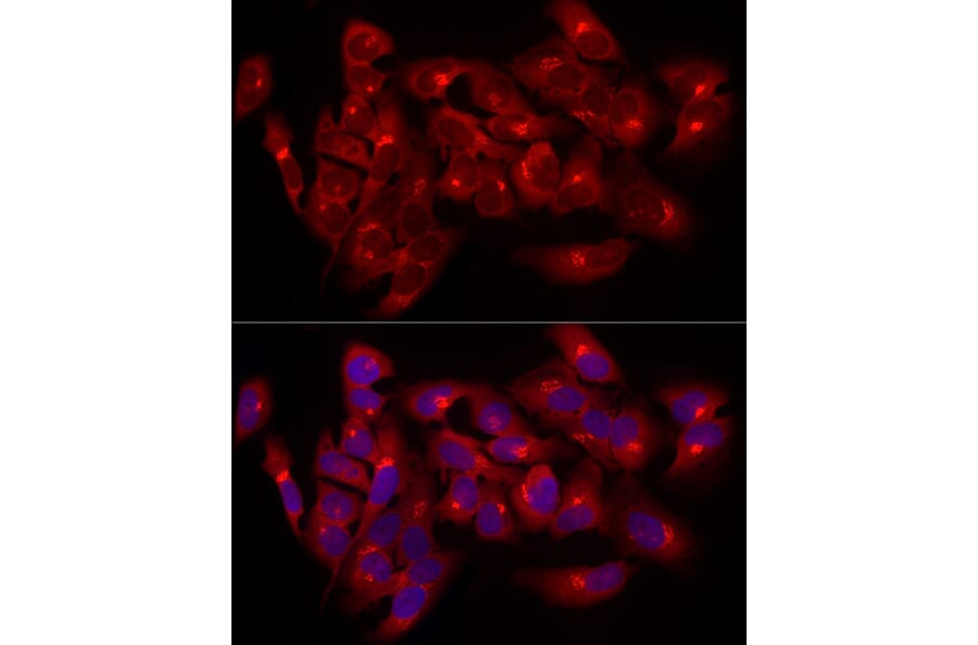 Immunofluorescence - Anti-Giantin Antibody (A309374) - Antibodies.com