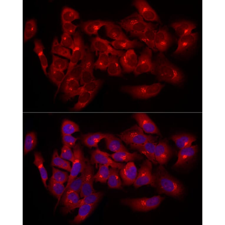 Immunofluorescence - Anti-Giantin Antibody (A309374) - Antibodies.com
