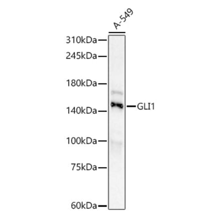 Western Blot - Anti-Gli1 Antibody [ARC59108] (A309375) - Antibodies.com