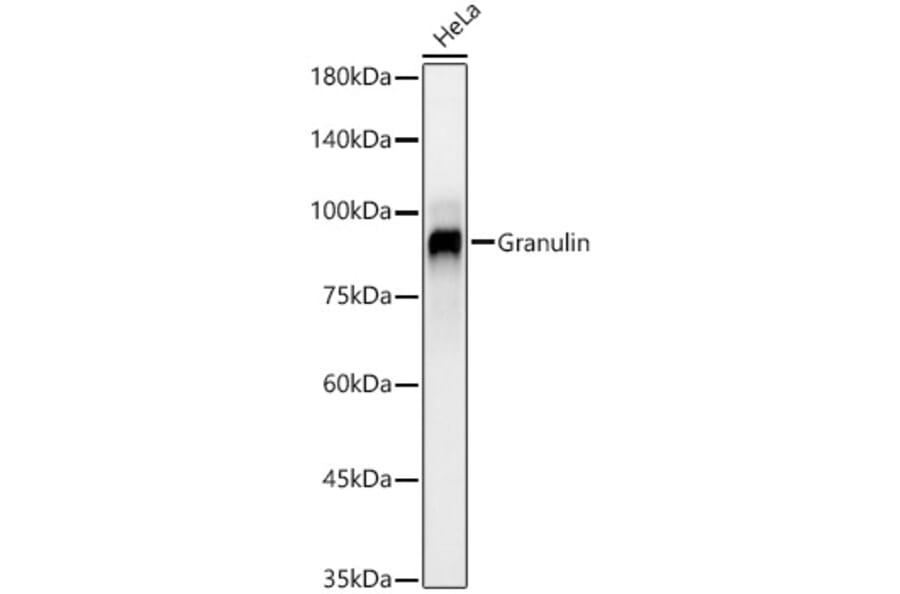 Western Blot - Anti-Granulin Antibody [ARC59451] (A309379) - Antibodies.com