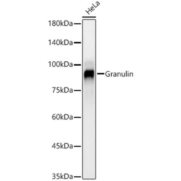 Western Blot - Anti-Granulin Antibody [ARC59451] (A309379) - Antibodies.com