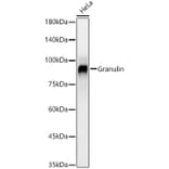 Western Blot - Anti-Granulin Antibody [ARC59451] (A309379) - Antibodies.com