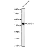 Western Blot - Anti-Granulin Antibody [ARC59451] (A309379) - Antibodies.com