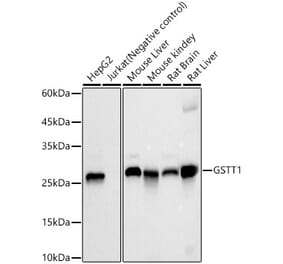 Western Blot - Anti-GSTT1 Antibody [ARC59201] (A309381) - Antibodies.com