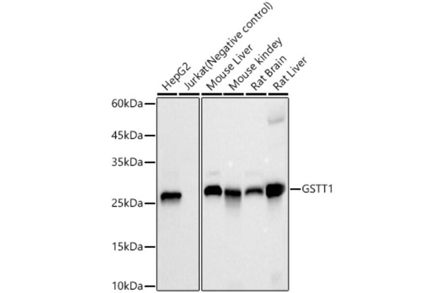 Western Blot - Anti-GSTT1 Antibody [ARC59201] (A309381) - Antibodies.com