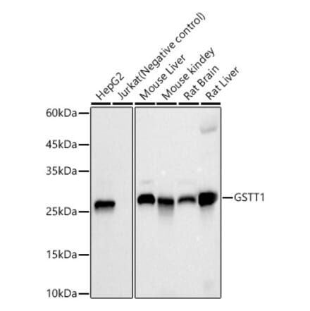 Western Blot - Anti-GSTT1 Antibody [ARC59201] (A309381) - Antibodies.com