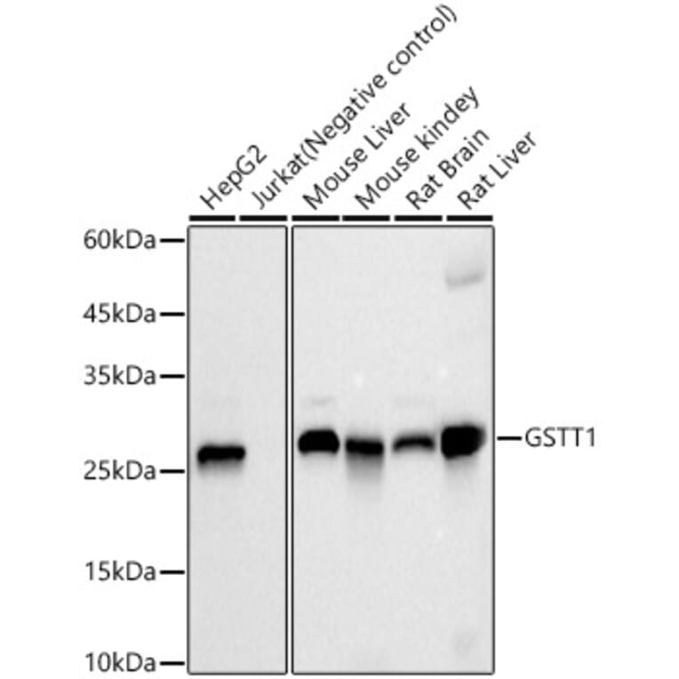 Western Blot - Anti-GSTT1 Antibody [ARC59201] (A309381) - Antibodies.com