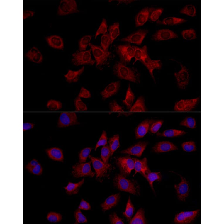 Immunofluorescence - Anti-HADHA Antibody (A309382) - Antibodies.com