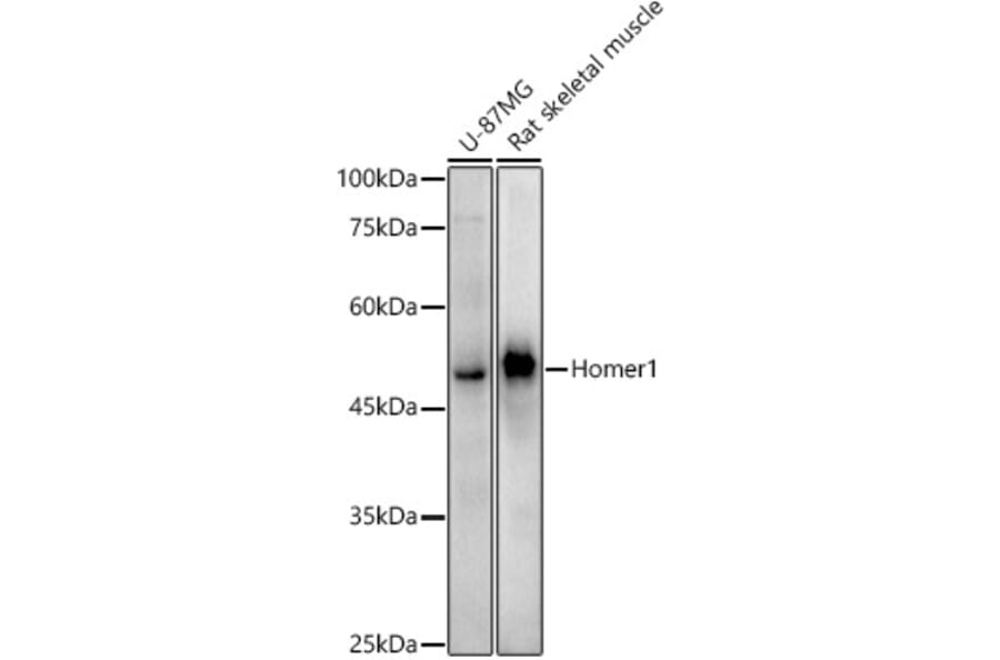 Western Blot - Anti-Homer1 Antibody [ARC3008] (A309385) - Antibodies.com