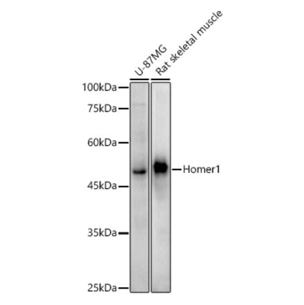 Western Blot - Anti-Homer1 Antibody [ARC3008] (A309385) - Antibodies.com