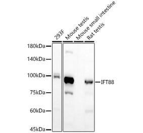 Western Blot - Anti-IFT88 Antibody [ARC57206] (A309388) - Antibodies.com