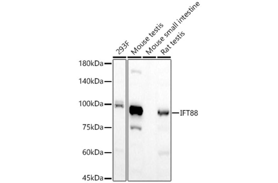 Western Blot - Anti-IFT88 Antibody [ARC57206] (A309388) - Antibodies.com