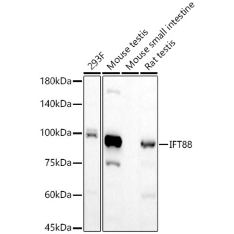 Western Blot - Anti-IFT88 Antibody [ARC57206] (A309388) - Antibodies.com