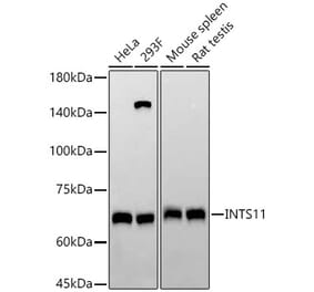 Western Blot - Anti-INTS11 Antibody [ARC58804] (A309390) - Antibodies.com