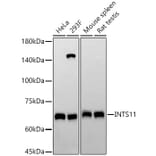 Western Blot - Anti-INTS11 Antibody [ARC58804] (A309390) - Antibodies.com