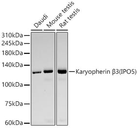 Western Blot - Anti-IPO5 Antibody [ARC59432] (A309391) - Antibodies.com