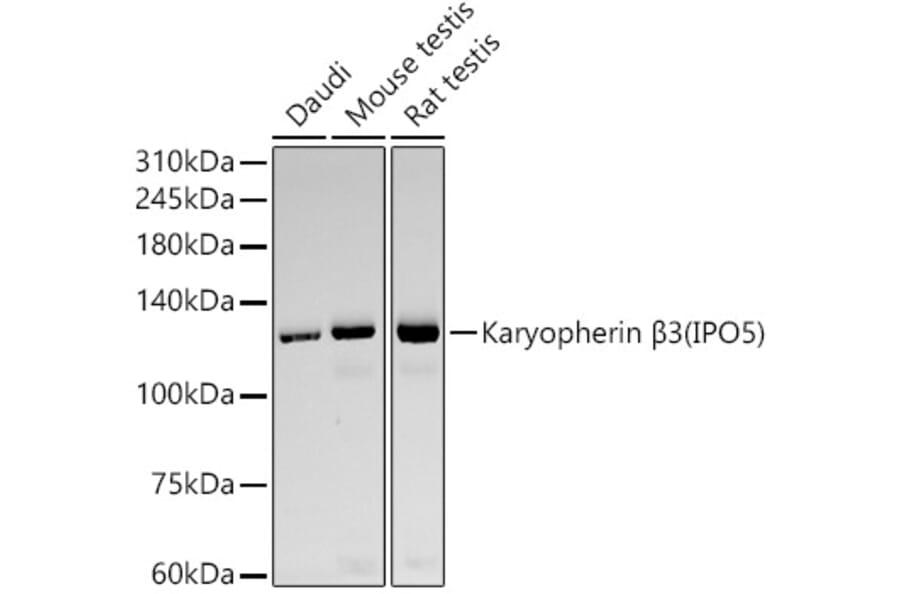 Western Blot - Anti-IPO5 Antibody [ARC59432] (A309391) - Antibodies.com
