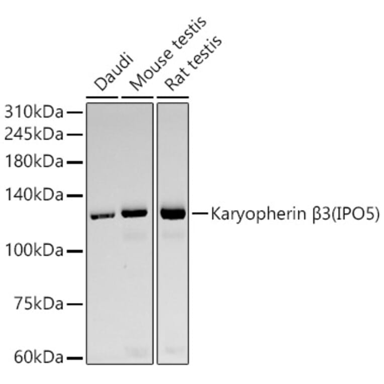Western Blot - Anti-IPO5 Antibody [ARC59432] (A309391) - Antibodies.com